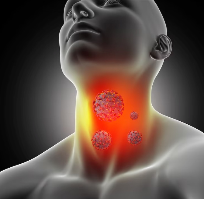 Рак щитовидной железы