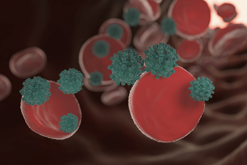 Лейкоз (лейкемия, рак крови)