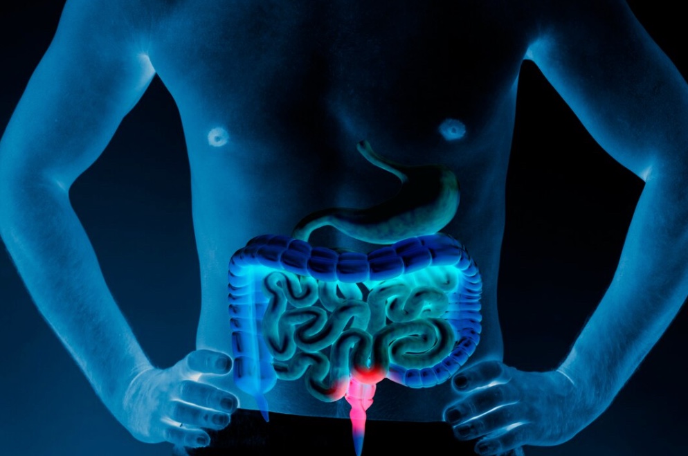 Рак прямой кишки