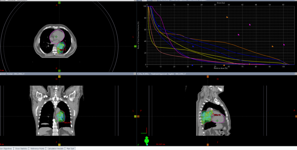 Курса дистанционной лучевой терапии